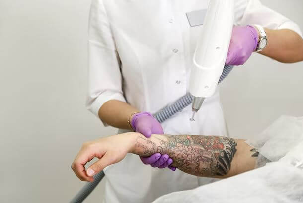 Tattoo Removal Clinic in Model Town
