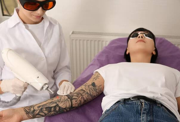 Tattoo Removal Clinic in Shalimar