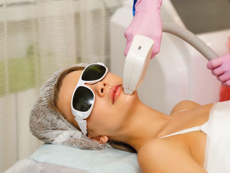 Laser Hair Removal Treatment Clinic in Rohini